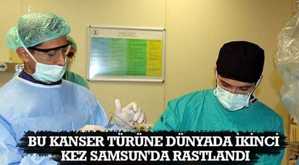 SAMSUN HABER - Bu kanser türüne dünyada ikinci kez Samsun'da rastlandı