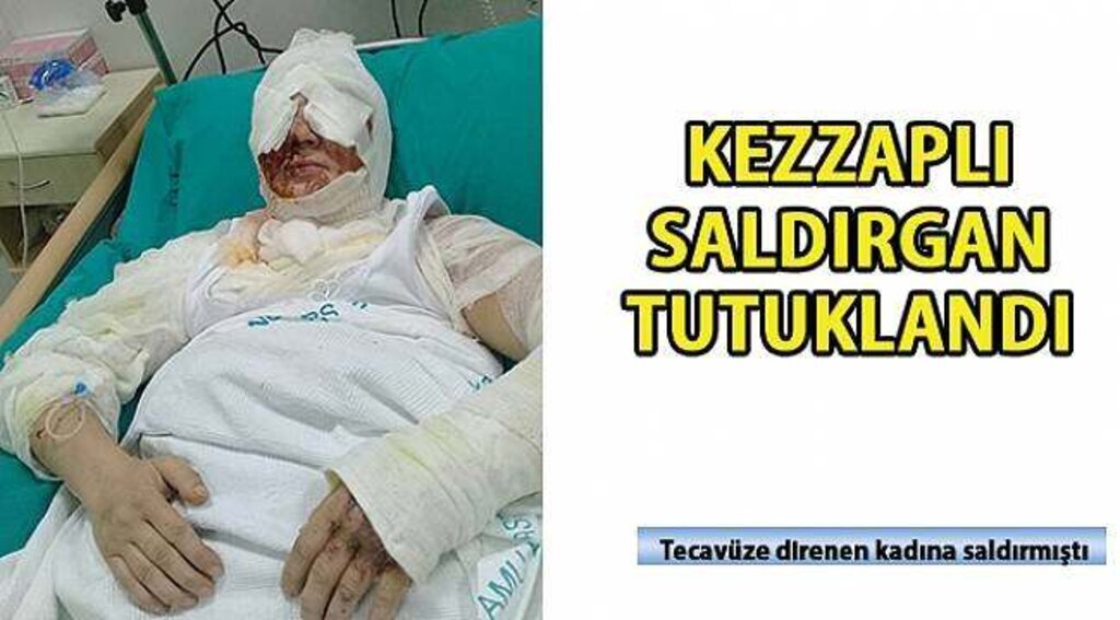 SAMSUN HABER - O saldırgan tutuklandı