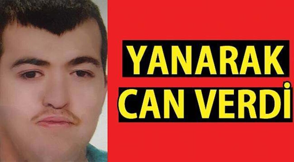 SAMSUN HABER - Ocaktan elbisesi tutuşan engelli genç kurtarılamadı