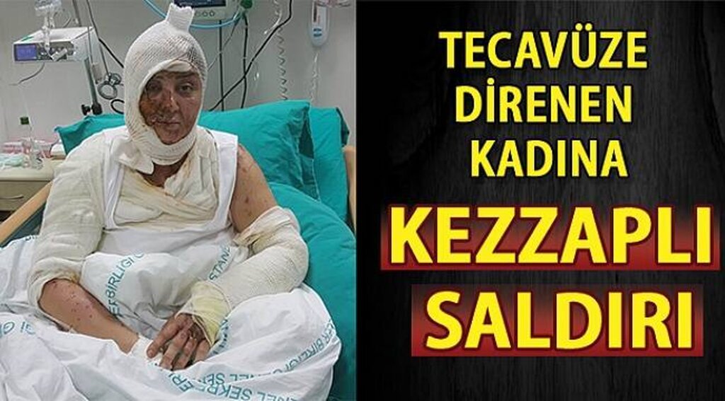 SAMSUN HABER - Tecavüze direnen kadına kezzapla saldırı