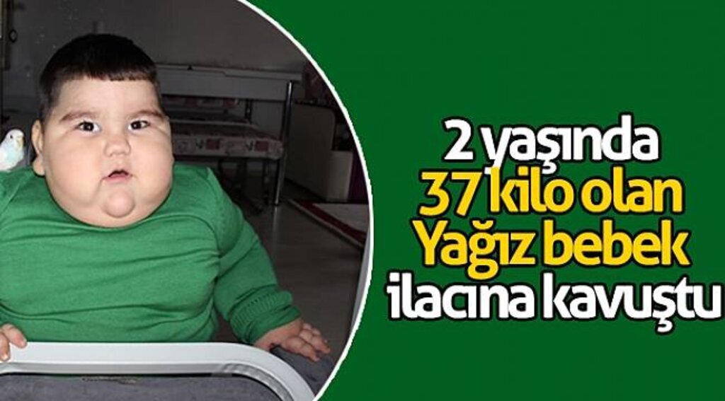 2 yaşında 37 kilo olan Yağız bebek ilacına kavuştu