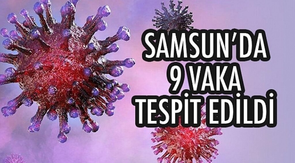 Samsun'da 9 pozitif vaka tespit edildi