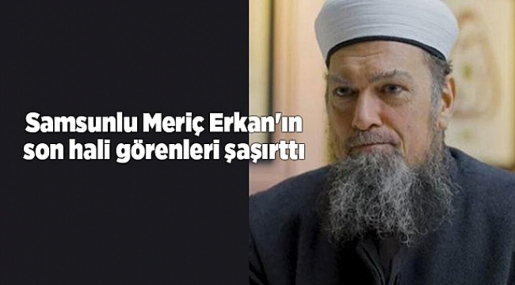 Samsunlu Meriç Erkan'ın son hali görenleri şaşırttı