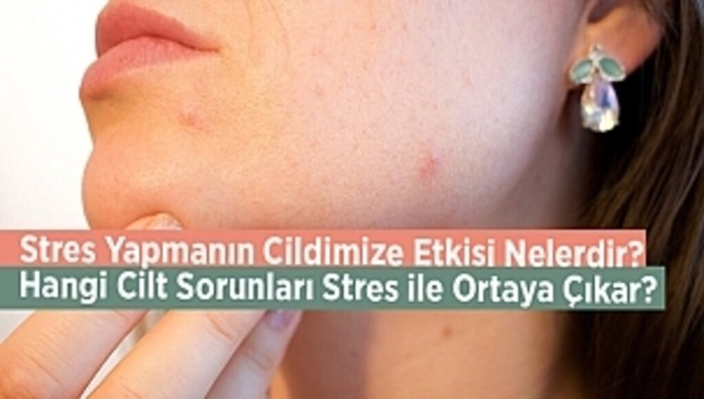 Stres Yapmanın Cildimize Etkisi Nelerdir? Hangi Cilt Sorunları Stres ile Ortaya Çıkar?