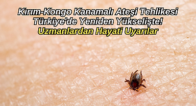 Kırım-Kongo Kanamalı Ateşi Tehlikesi Türkiye'de Yeniden Yükselişte! Uzmanlardan Hayati Uyarılar