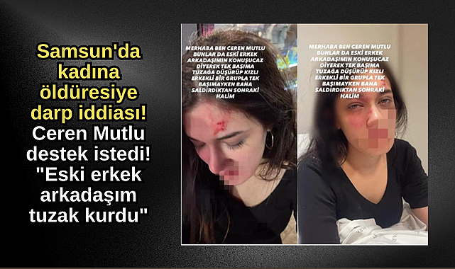 Samsun'da kadına öldüresiye darp iddiası!